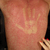 Thumb_sq_dengue-por-lenings_lethicia
